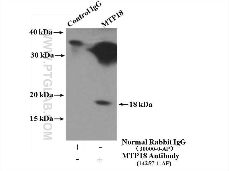 IP experiment of mouse heart using 14257-1-AP