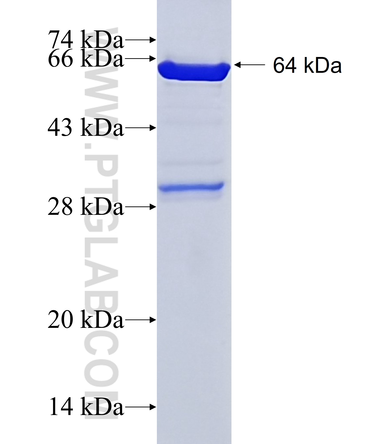 MTR fusion protein Ag23156 SDS-PAGE