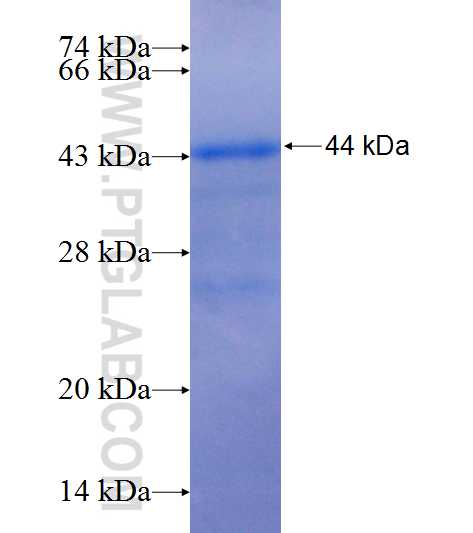 MTRR fusion protein Ag25678 SDS-PAGE