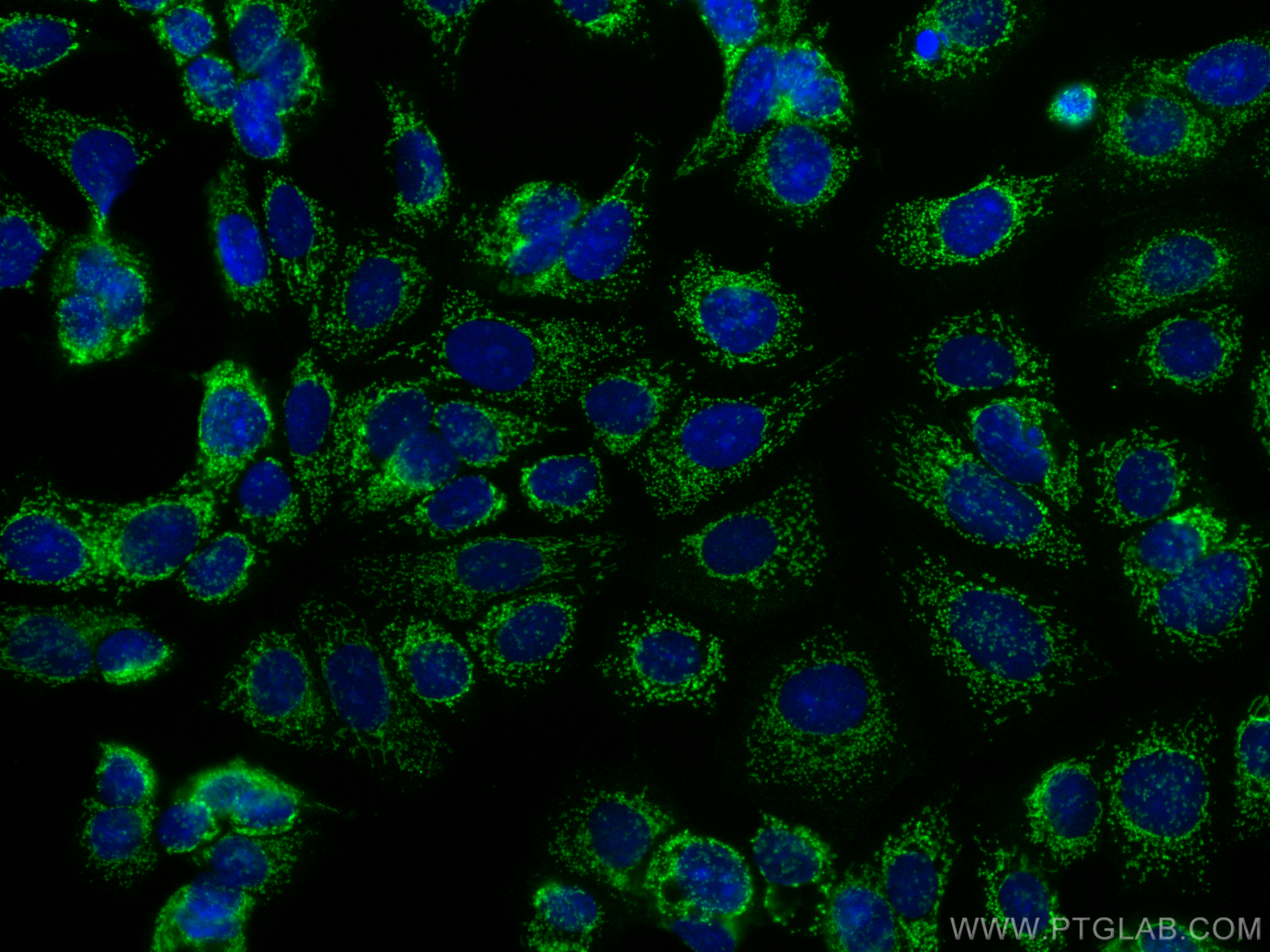 IF Staining of MCF-7 using 27832-1-AP