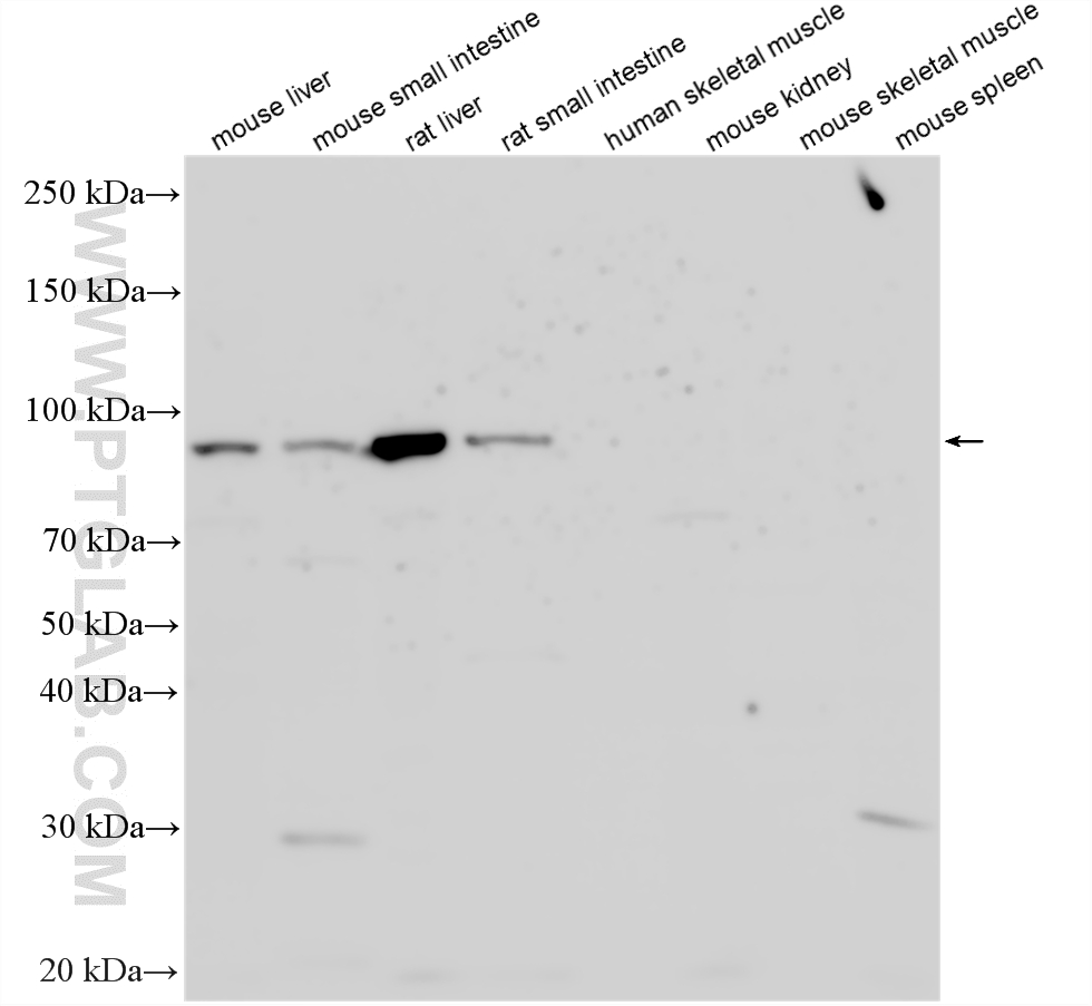 Various lysates were subjected to SDS PAGE followed by western blot with 23940-1-AP (MTTP antibody) at dilution of 1:1500 incubated at room temperature for 1.5 hours. Negative control: human skeletal muscle tissue, mouse kidney tissue, mouse skeletal muscle tissue, mouse spleen tissue. WB analysis using 23940-1-AP