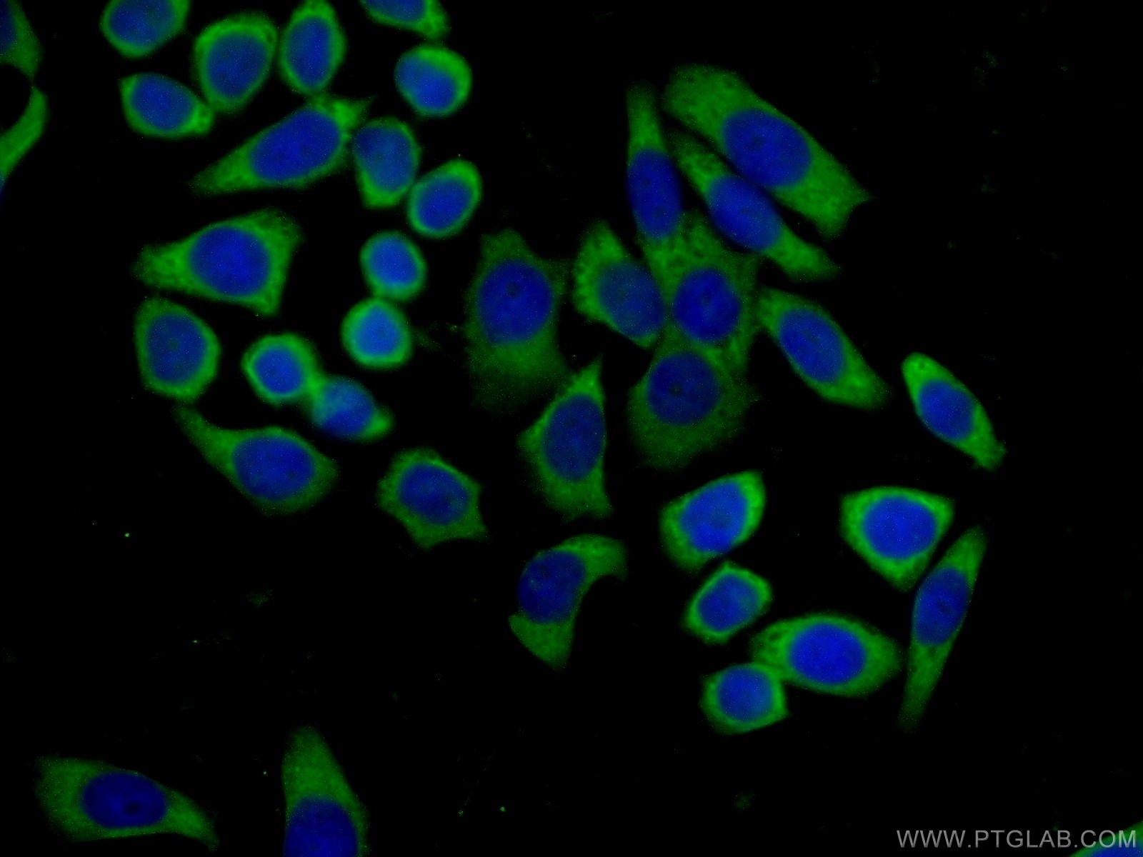 IF Staining of PC-3 using 13436-1-AP