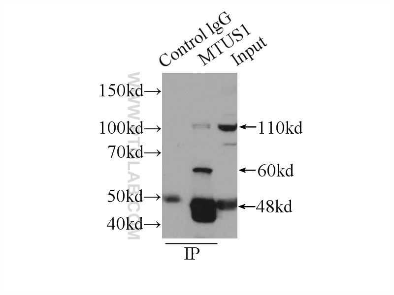 IP experiment of mouse brain using 13436-1-AP