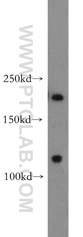 WB analysis of human skeletal muscle using 18791-1-AP