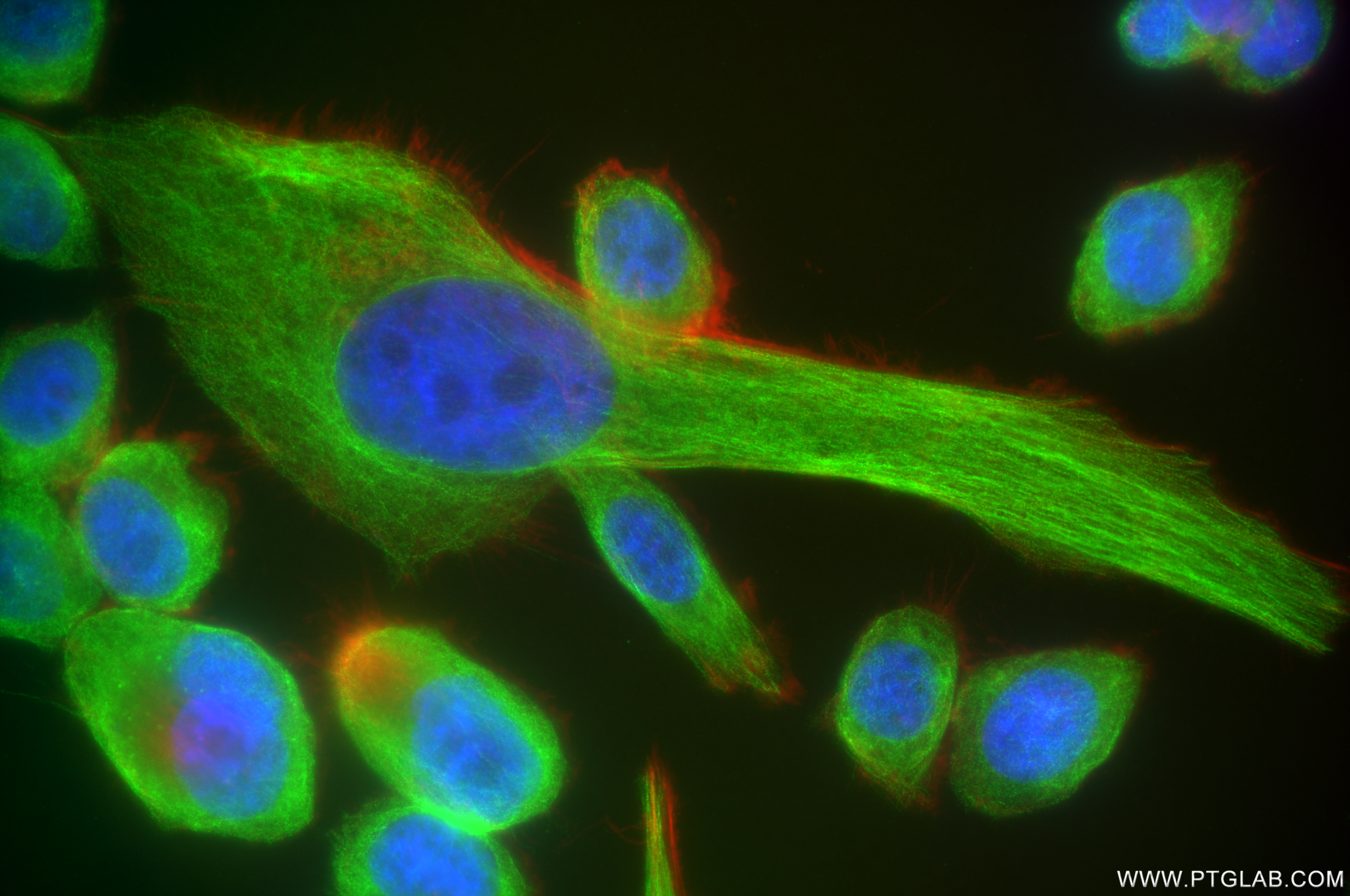 IF Staining of PC-3 using 85117-4-RR (same clone as 85117-4-PBS)