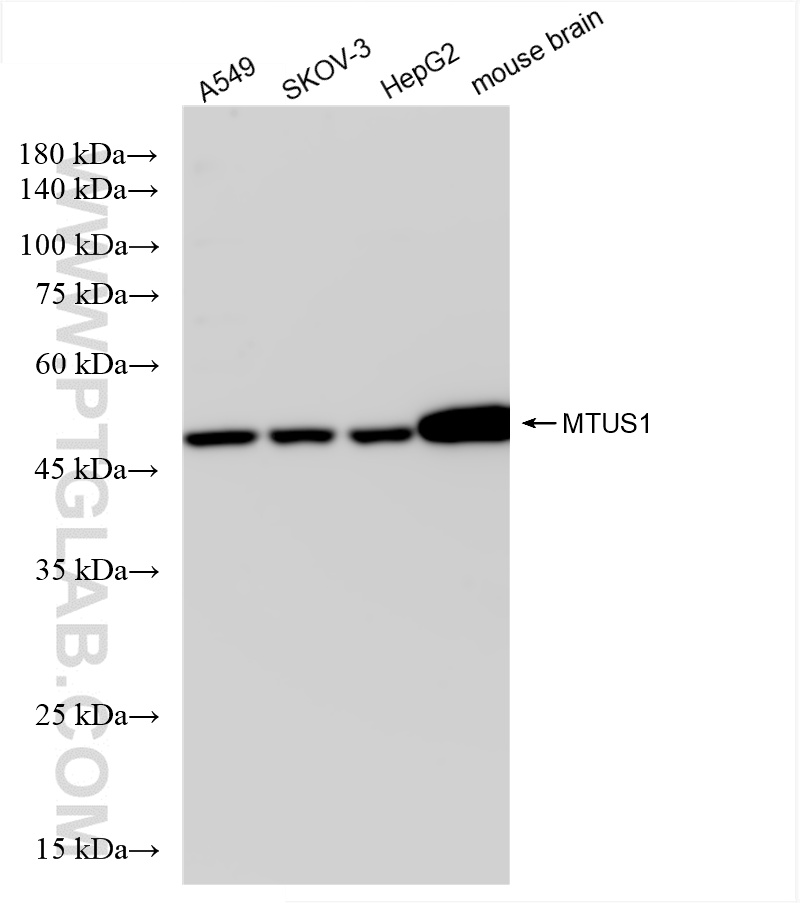 WB analysis using 85117-4-RR (same clone as 85117-4-PBS)