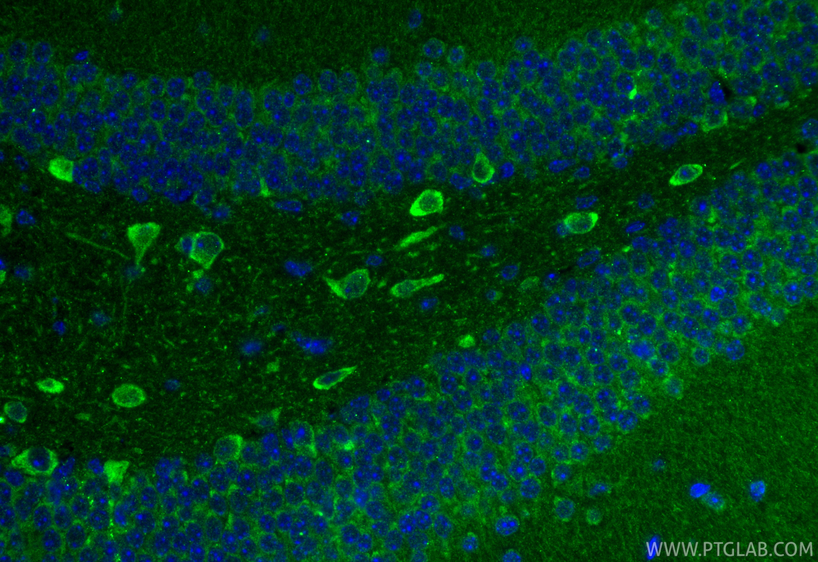 IF Staining of mouse brain using 15529-1-AP IF Staining of mouse brain using 15529-1-AP