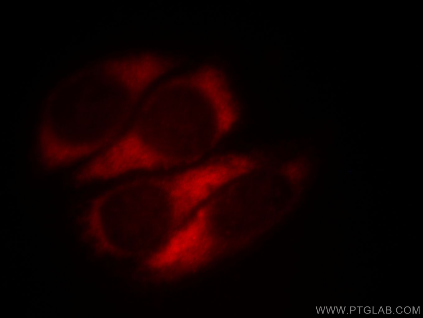 IF Staining of HepG2 using 11610-1-AP