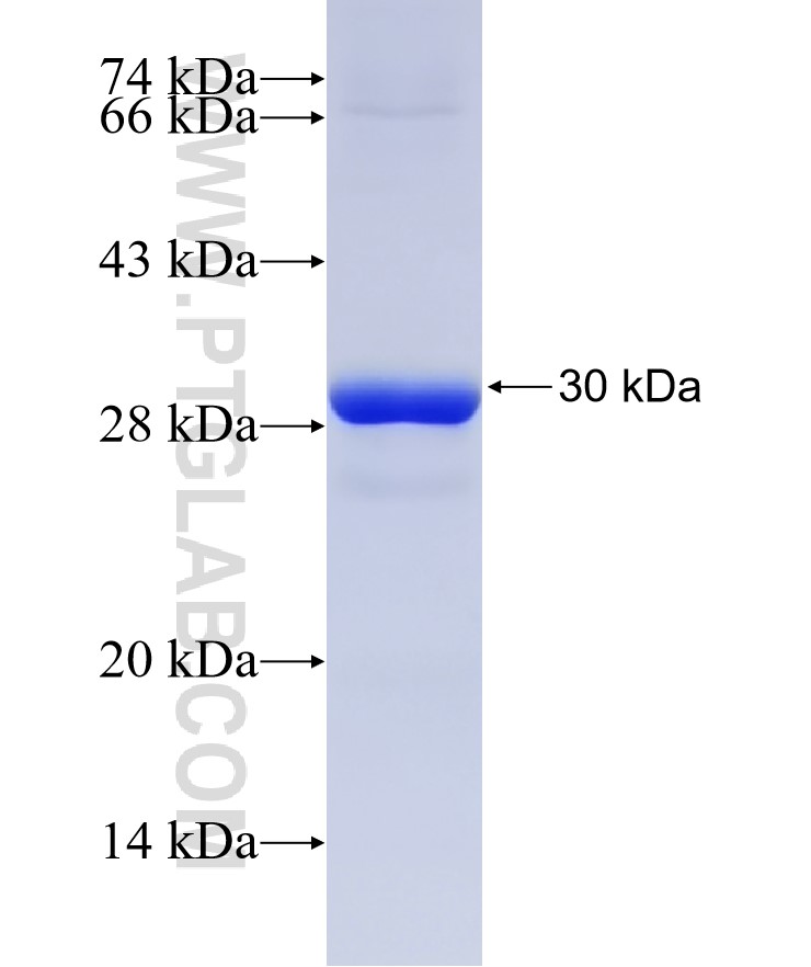 MTX2 fusion protein Ag22889 SDS-PAGE MTX2 fusion protein Ag22889 SDS-PAGE
