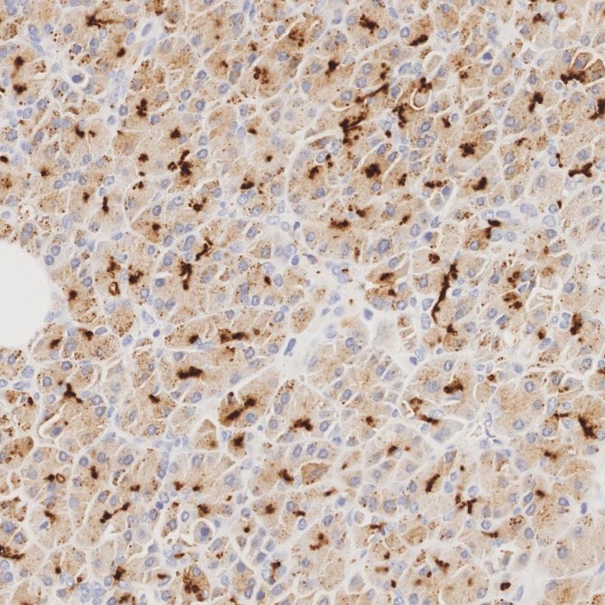 IHC staining of human pancreas using 83311-4-RR IHC staining of human pancreas using 83311-4-RR