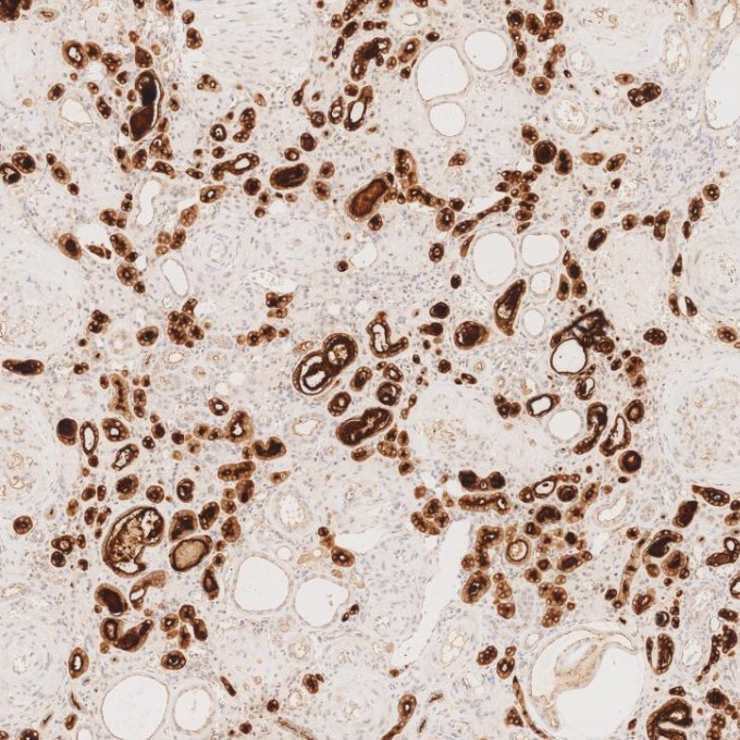 IHC staining of human kidney using 83311-4-RR IHC staining of human kidney using 83311-4-RR