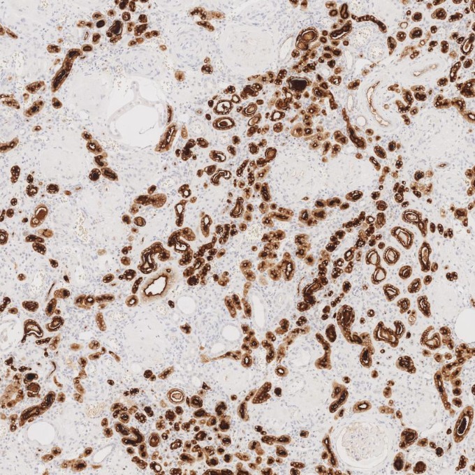 IHC staining of human kidney using 83311-4-RR IHC staining of human kidney using 83311-4-RR