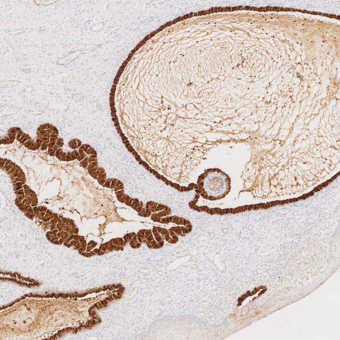 IHC staining of human cervix using 83311-4-RR IHC staining of human cervix using 83311-4-RR