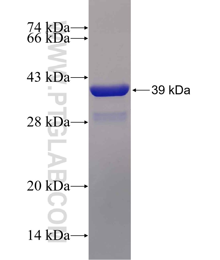 MUC1 fusion protein Ag30431 SDS-PAGE