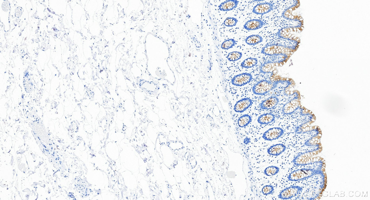 Immunohistochemical analysis of paraffin-embedded human colon tissue slide using <a class='green' href='/productredirect?CatalogNo=87107-2-RR' target='_blank'>87107-2-RR</a> (MUC13 antibody) at dilution of 1:1000 (under 20x lens). Heat mediated antigen retrieval with Tris-EDTA buffer (pH 9.0). This data was developed using the same antibody clone with 87107-2-PBS in a different storage buffer formulation. IHC staining of human colon using 87107-2-RR (same clone as 87107-2-PBS)
