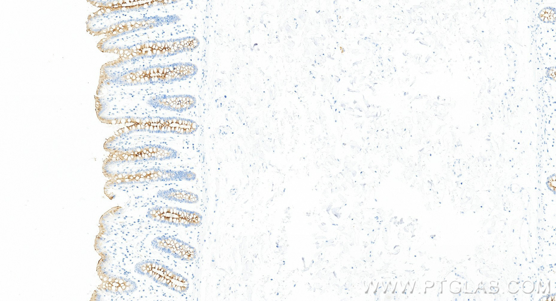 IHC staining of human colon using 98683-1-RR