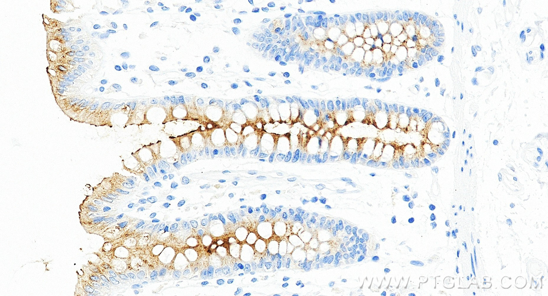 IHC staining of human colon using 98683-1-RR