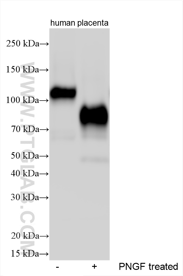 WB analysis using 33669-1-AP (same clone as 33669-1-PBS) WB analysis using 33669-1-AP (same clone as 33669-1-PBS)