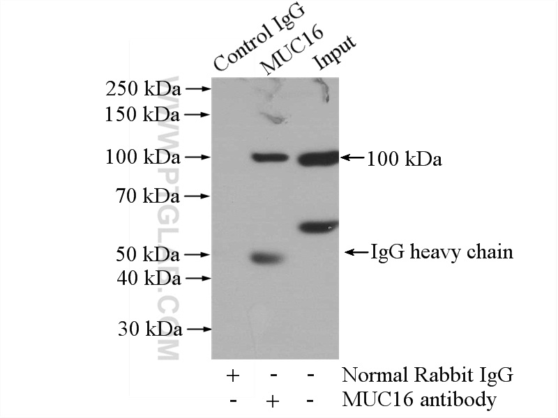 IP experiment of HeLa using 20077-1-AP