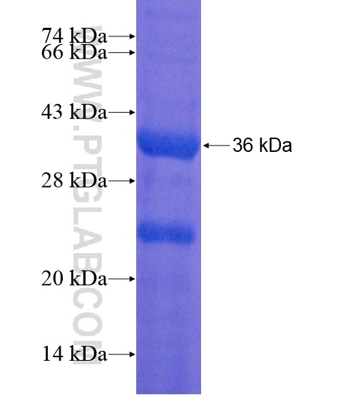 MUC17 fusion protein Ag18964 SDS-PAGE MUC17 fusion protein Ag18964 SDS-PAGE