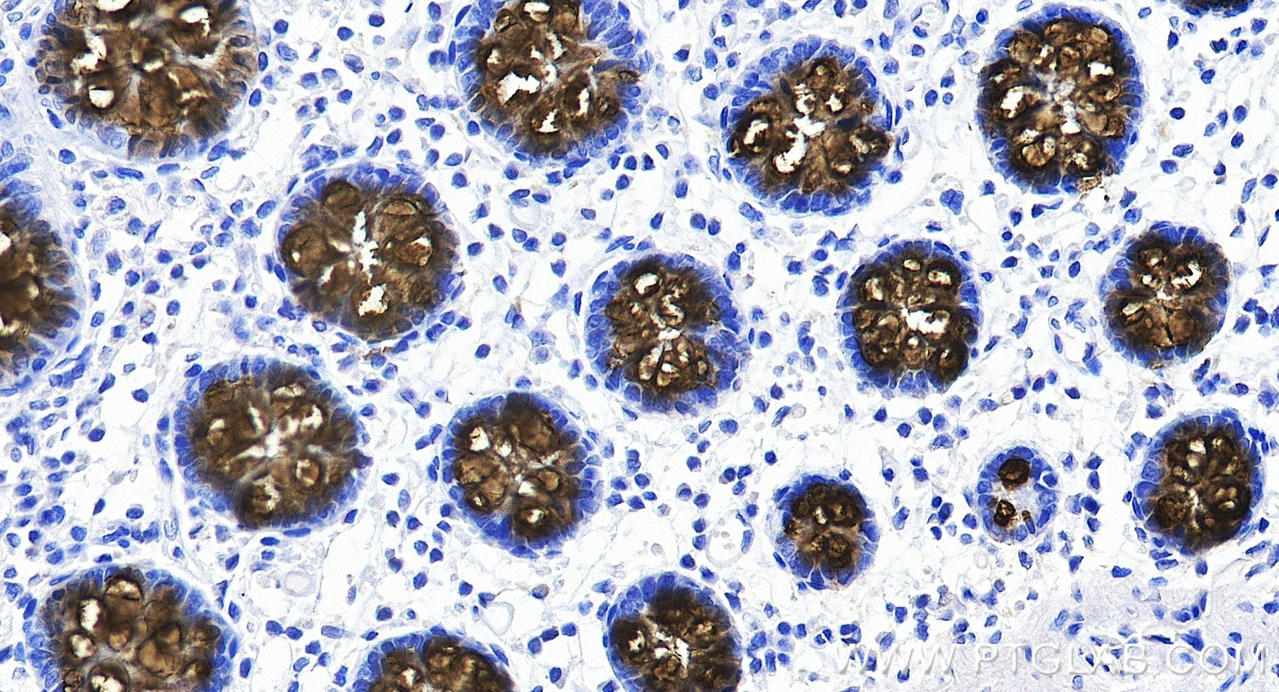 IHC staining of human colon using 82792-2-RR