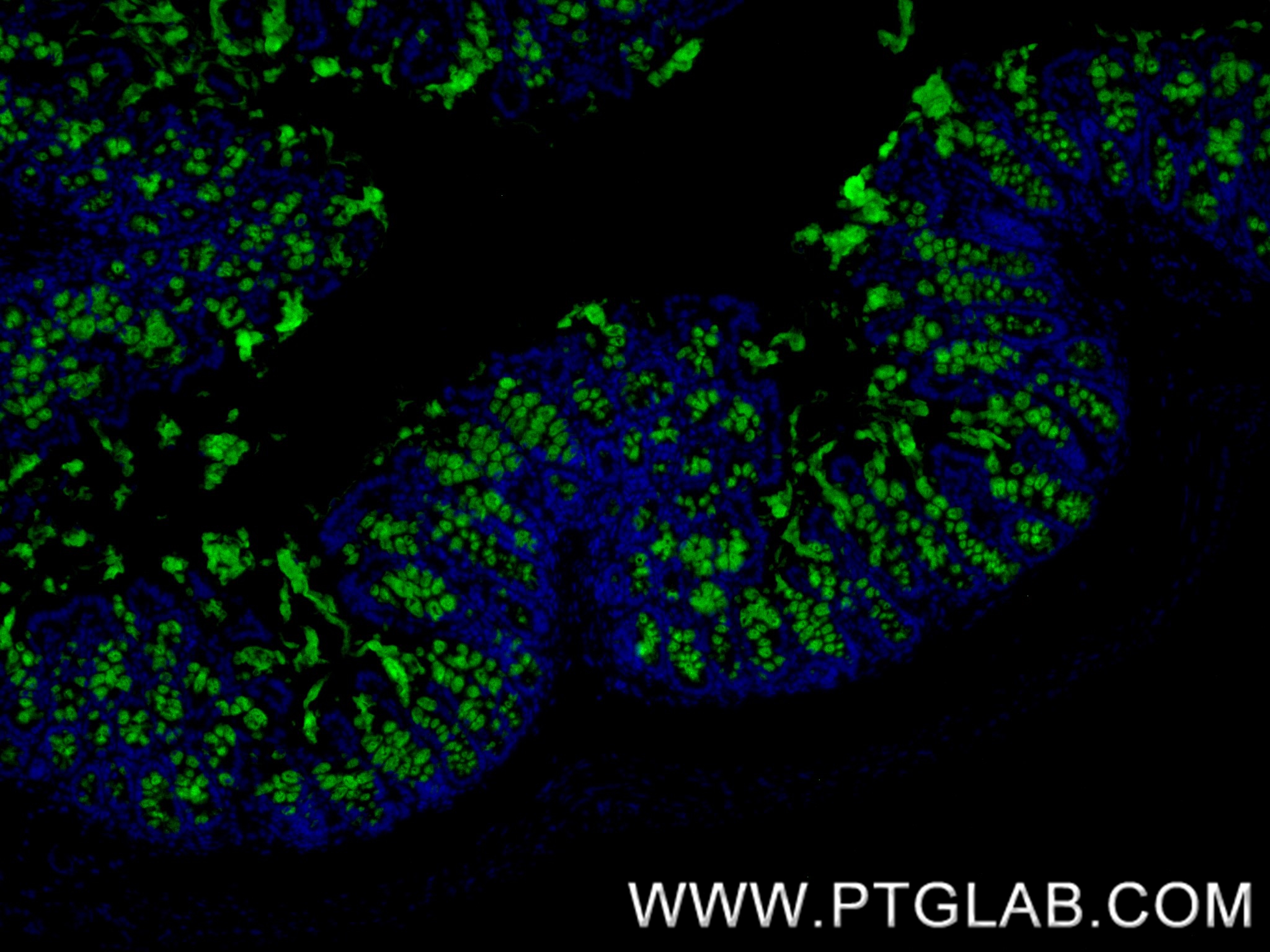 IF Staining of mouse colon using 82792-2-RR