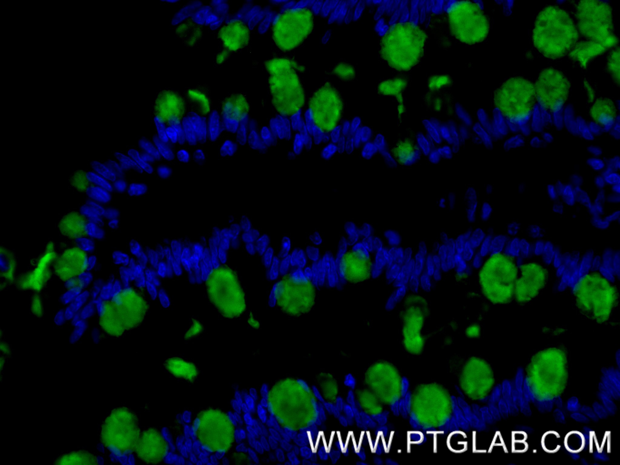 IF Staining of human small intestine using 82792-2-RR IF Staining of human small intestine using 82792-2-RR