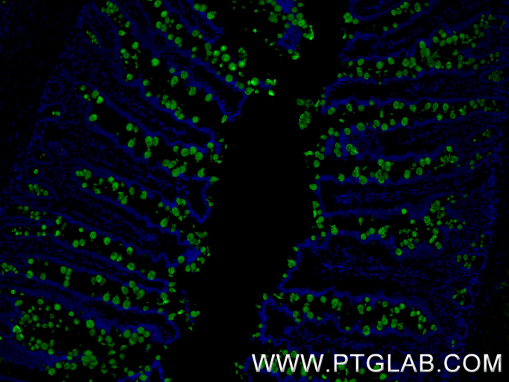 IF Staining of human small intestine using 82792-2-RR IF Staining of human small intestine using 82792-2-RR