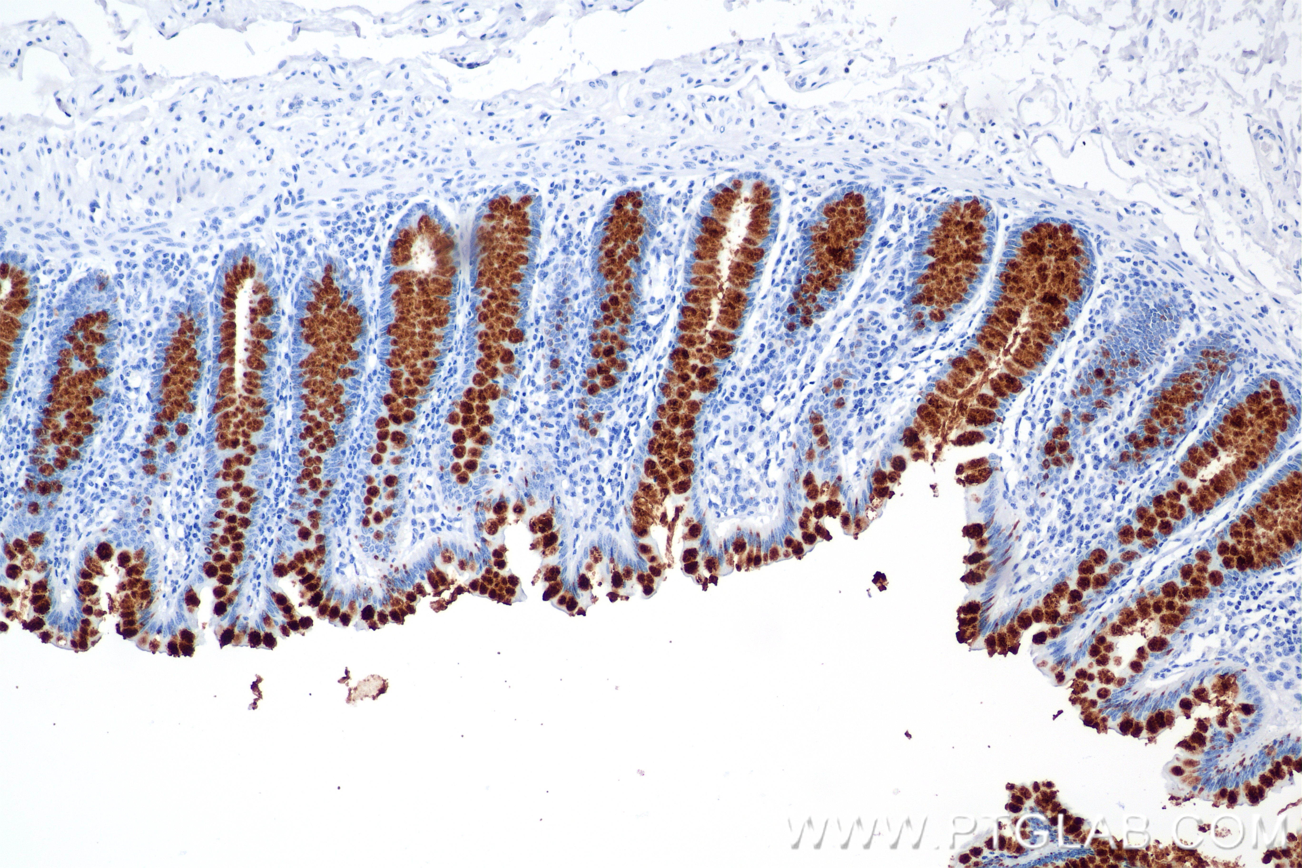 IHC staining of human colon using 82792-2-RR