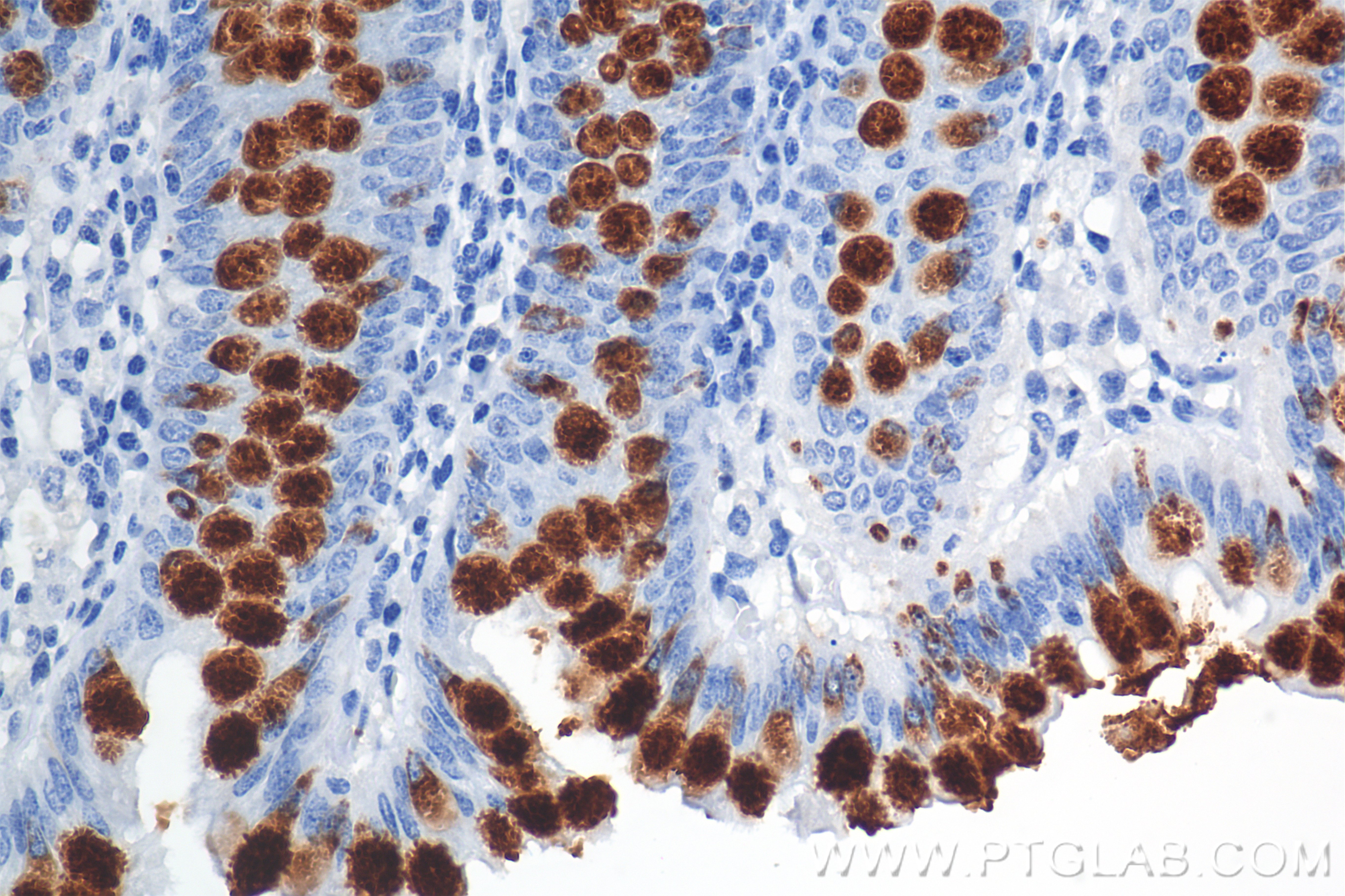 IHC staining of human colon using 82792-2-RR