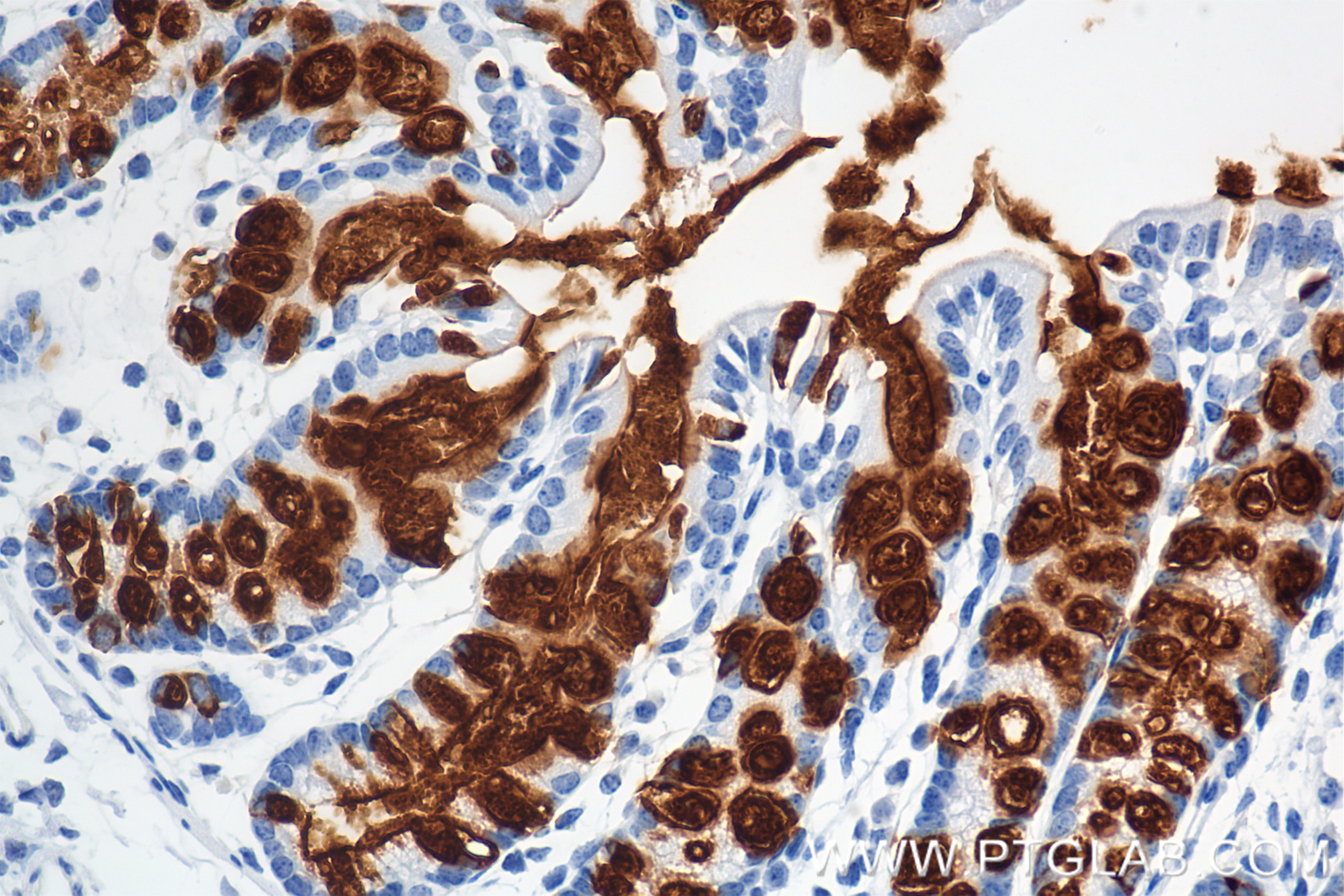 IHC staining of mouse colon using 82792-2-RR