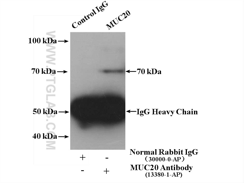 IP experiment of mouse liver using 13380-1-AP