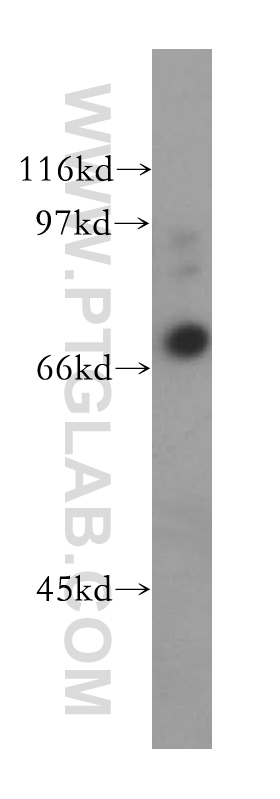 WB analysis of human liver using 13380-1-AP