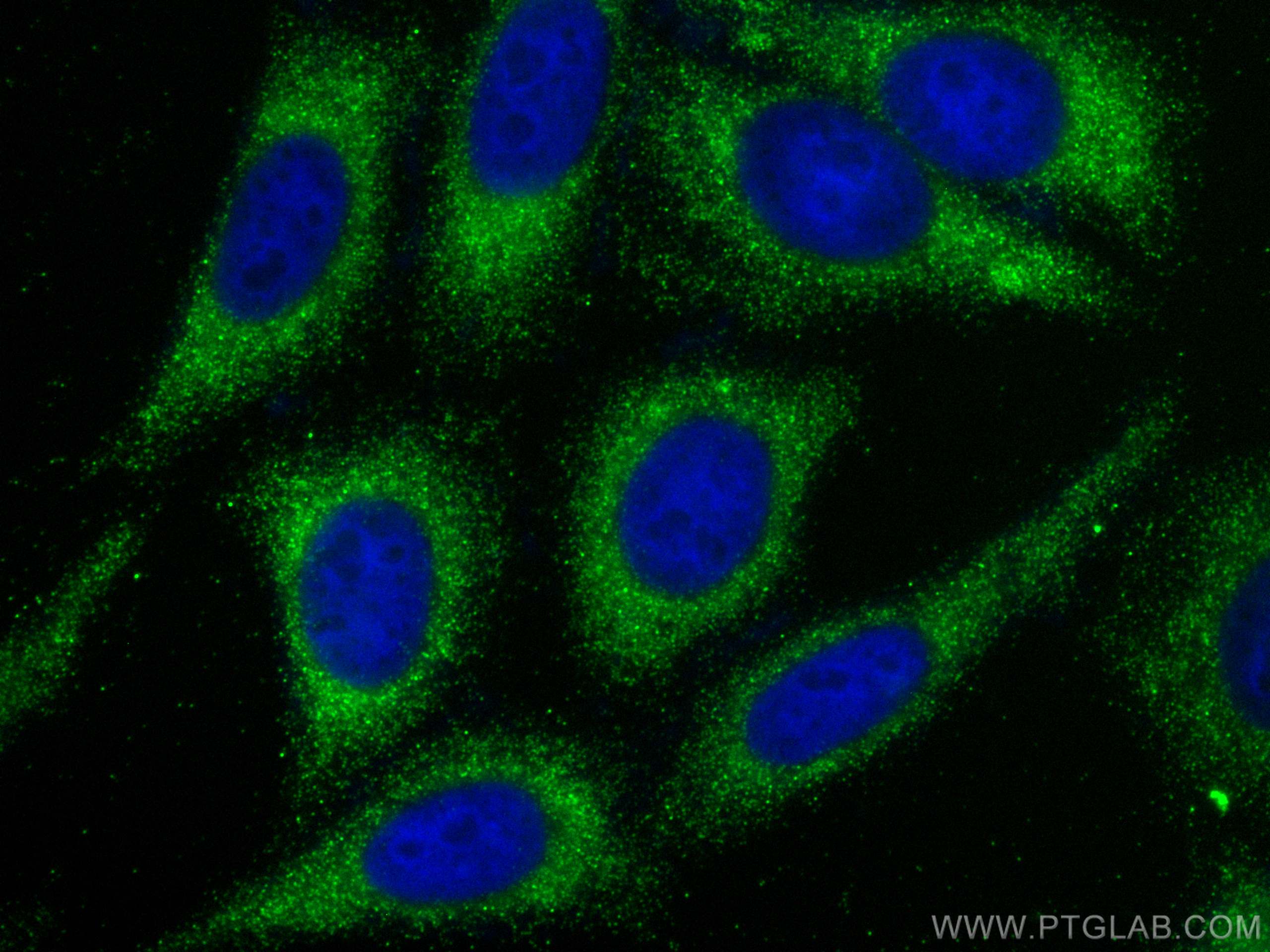 IF Staining of HepG2 using 30457-1-AP (same clone as 30457-1-PBS)