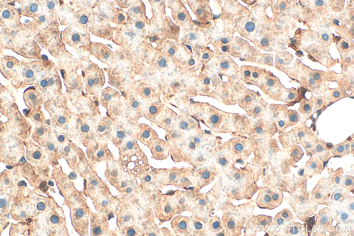 IHC staining of rat liver using 30457-1-AP