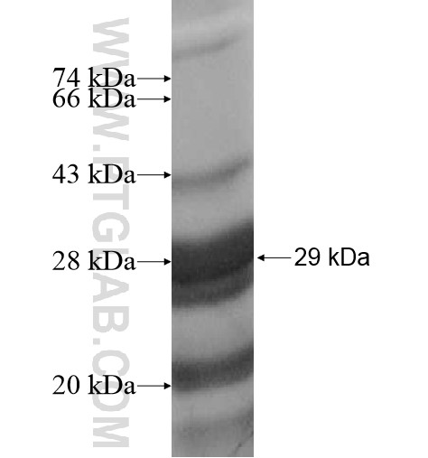 MUC21 fusion protein Ag16003 SDS-PAGE MUC21 fusion protein Ag16003 SDS-PAGE