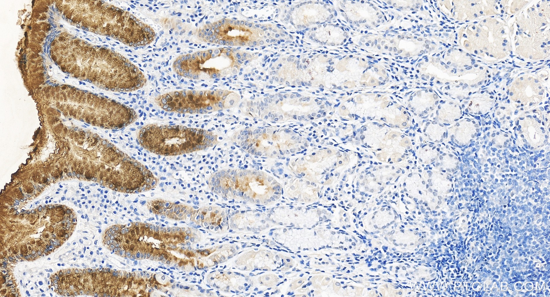 IHC staining of human stomach using 85868-1-RR IHC staining of human stomach using 85868-1-RR