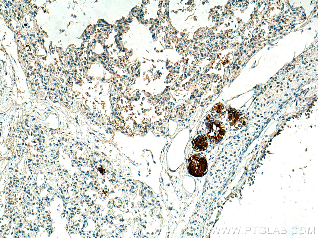 IHC staining of human lung using 28118-1-AP