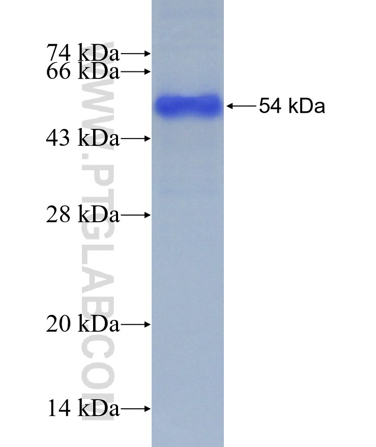 MUC5B fusion protein Ag27886 SDS-PAGE