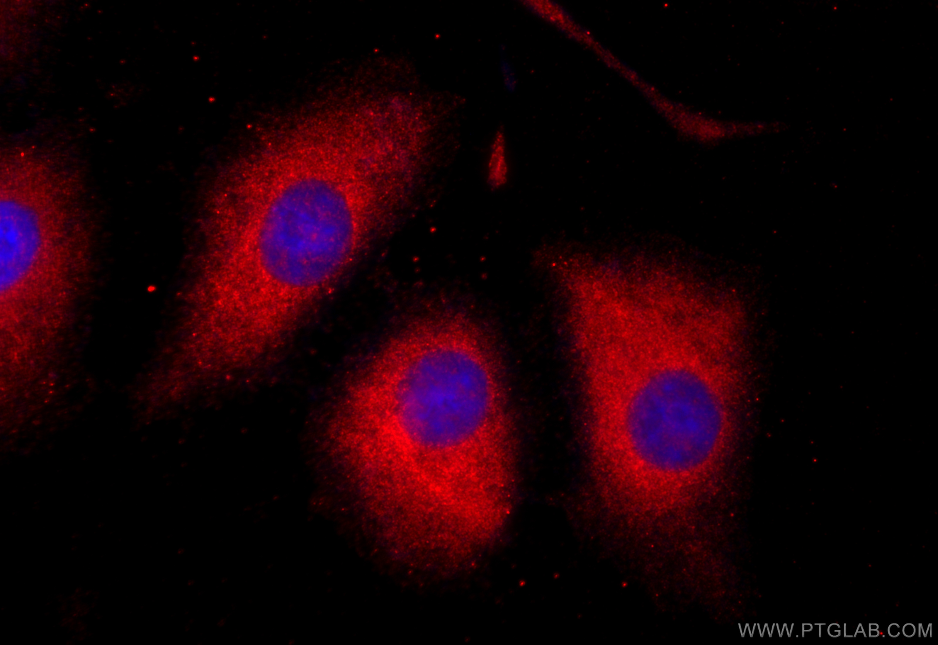 IF Staining of A549 using 55489-1-AP