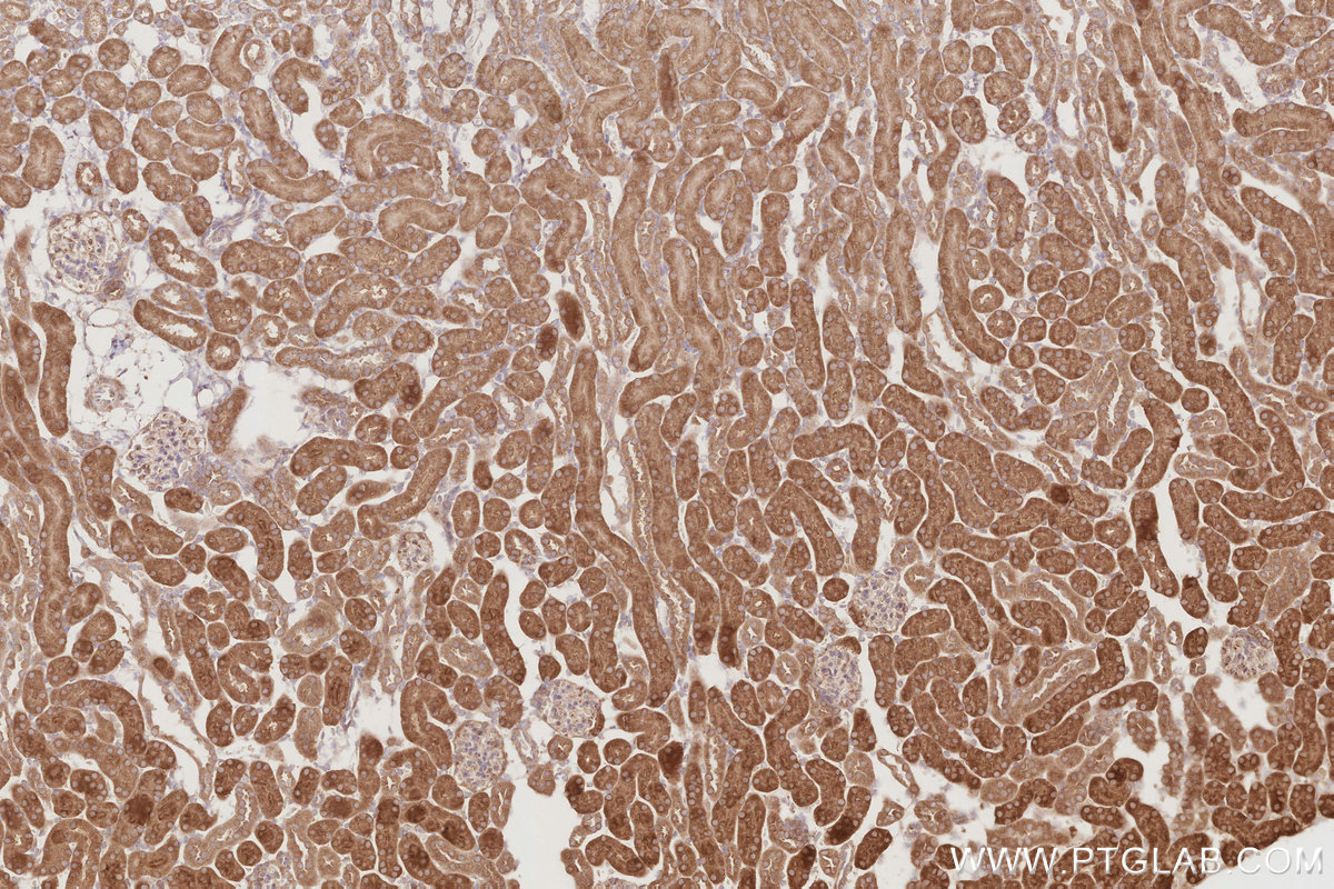 IHC staining of mouse kidney using 26567-1-AP IHC staining of mouse kidney using 26567-1-AP