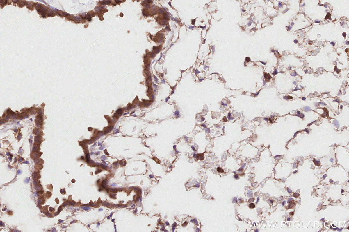 IHC staining of mouse lung using 26567-1-AP IHC staining of mouse lung using 26567-1-AP