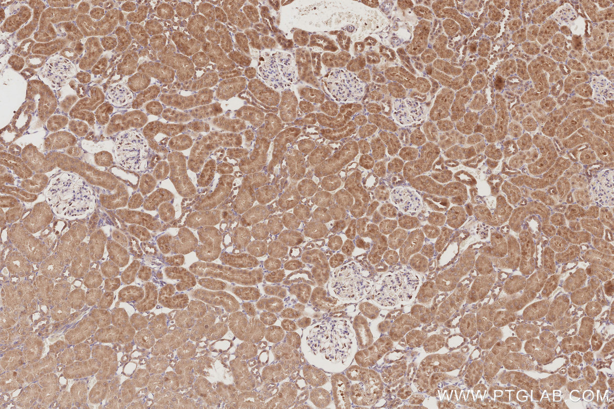 IHC staining of rat kidney using 26567-1-AP IHC staining of rat kidney using 26567-1-AP