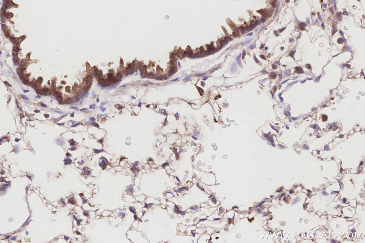 IHC staining of rat lung using 26567-1-AP IHC staining of rat lung using 26567-1-AP