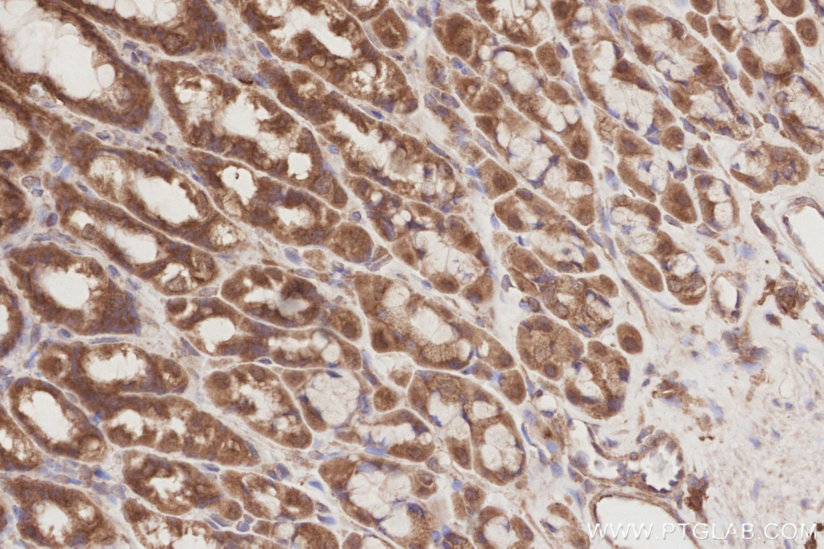 IHC staining of rat stomach using 26567-1-AP IHC staining of rat stomach using 26567-1-AP