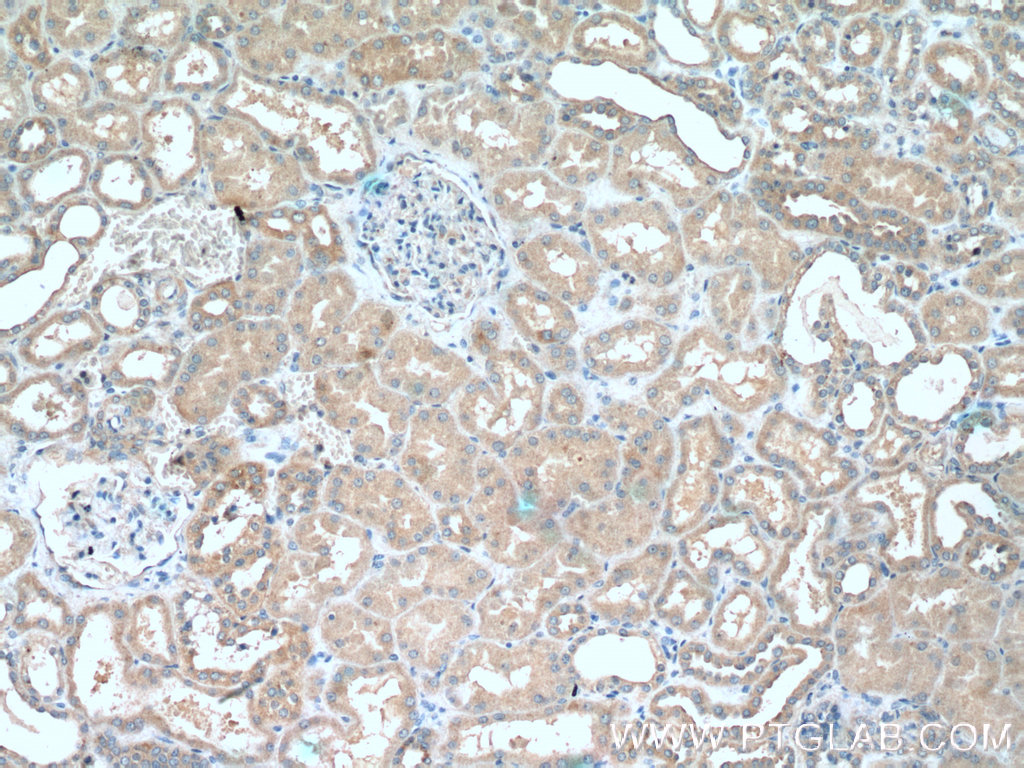 IHC staining of human kidney using 16133-1-AP IHC staining of human kidney using 16133-1-AP