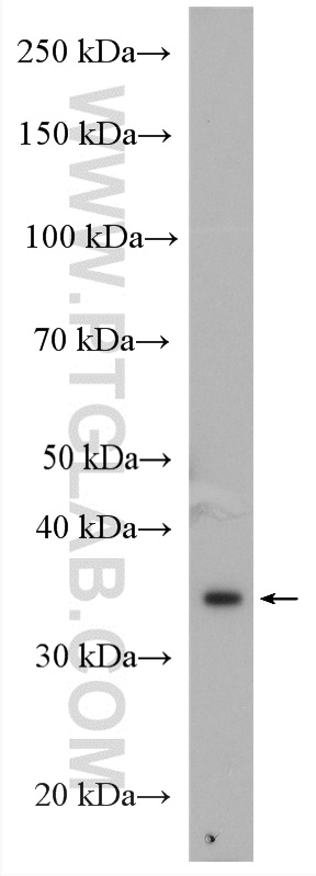 WB analysis of HeLa using 16133-1-AP