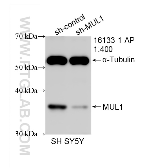 WB analysis of SH-SY5Y using 16133-1-AP WB analysis of SH-SY5Y using 16133-1-AP