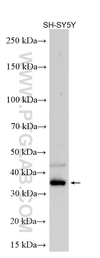 WB analysis using 16133-1-AP WB analysis using 16133-1-AP