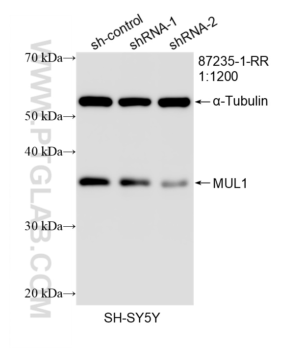 WB analysis of SH-SY5Y using 87235-1-RR WB analysis of SH-SY5Y using 87235-1-RR